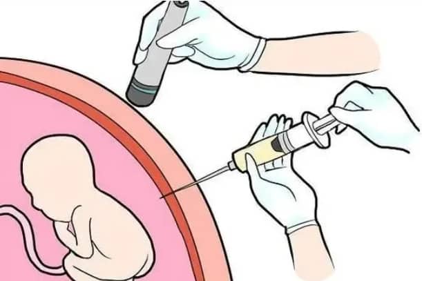 同济医院遗传学专家有哪些？遗传咨询门诊适用人群与挂号指南