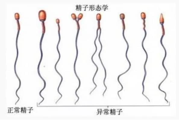 同济医院精子形态分析报告怎么看？正常值范围与备孕建议科普