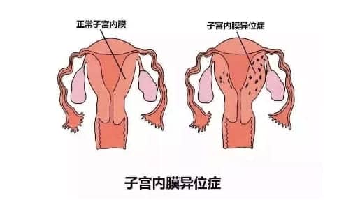 同济医院生殖科和协和医院生殖科哪个好？武汉两大生殖中心对比