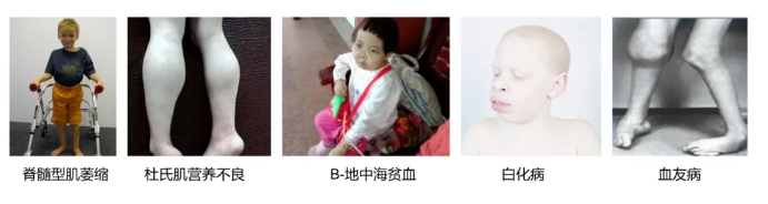 同济生殖中心医生排名怎么看？武汉试管婴儿专家选择标准与口碑参考