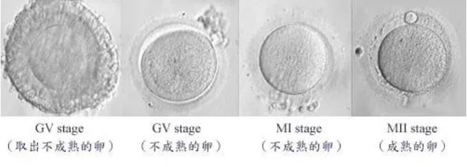 【2026实测】武汉私立医院供卵试管费用与公立对比：怎么选？
